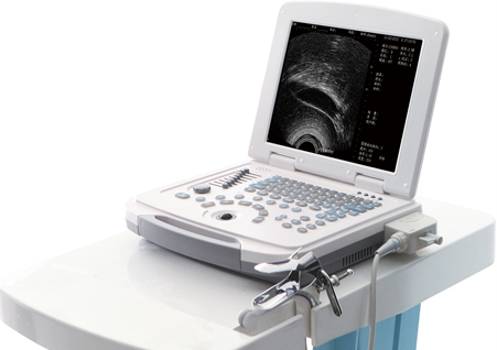  DW-400,全數(shù)字可視人流機(jī),便攜式可視人流機(jī)