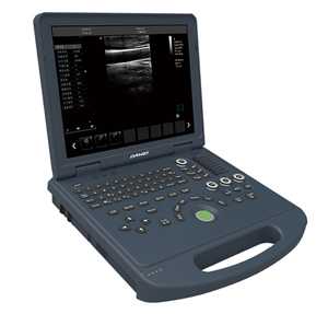 筆記本式全數字彩色多普勒超聲診斷儀